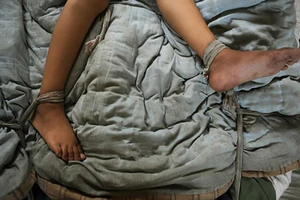 'Tâm sự' xong, trói cô gái để cướp trong khách sạn ở quận 10