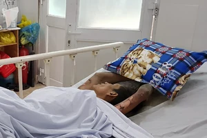 Thanh niên ngáo đá nhốt bạn gái, đốt phòng trọ ở Thủ Đức