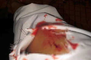 Công an làm việc với cô gái bị rạch tay ở Thủ Đức