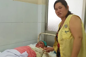 Người phụ nữ bị người tình tạt axit ở Bình Tân không qua khỏi
