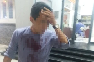 Anh tấn công em trai và mẹ bằng dao sau khi nhậu