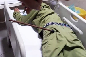 Bị kẻ nghi là trộm chó, chích điện ở Củ Chi