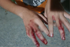 Vụ 'đánh cháu bé nát tay, bắt bán vé số': Hàng xóm nói gì?