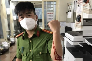 1 Cảnh sát khu vực ở quận 1 bị tấn công bằng dao khi kiểm tra hành chính