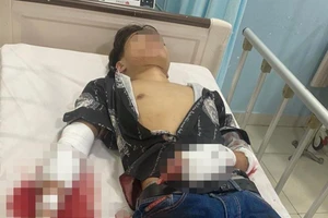 Công an truy tìm kẻ chủ mưu chém lìa tay thiếu niên trước quán cà phê