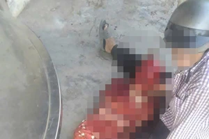 Chó cắn chết cụ bà 89 tuổi và cắn thêm 2 người ở Tây Ninh