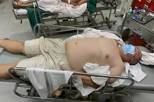 Người đi bộ bị xe máy tông trọng thương ở Bình Thạnh