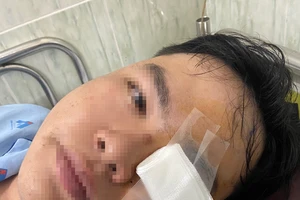 Thông tin mới vụ nam thanh niên tổn thương mắt do va trúng gậy CSGT 