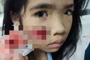 Đang chơi ở sân nhà thì bị khỉ hoang lao vào tấn công