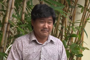 Người đàn ông lén vợ mua tóc giả vì căn bệnh hói đầu