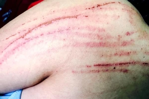 Đề nghị khởi tố vụ nữ luật sư bị đánh tại tòa