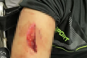 4 người đàn ông đánh trọng thương kỹ thuật viên Bệnh viện đa khoa Long An