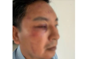 Công an Đồng Nai đang điều tra vụ 3 người xông vào đánh, nổ súng do mâu thuẫn nợ nần