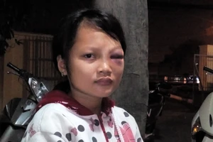 Đánh bé gái bằng nón bảo hiểm vì nghi trộm tiền