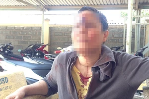 Một phụ nữ bị nhóm thanh niên đánh trọng thương