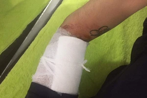 Đi giao hàng cho khách mua online, dính ổ cướp