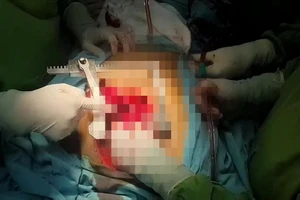 Cứu sống nam bệnh nhân nghi bị người yêu đâm trọng thương