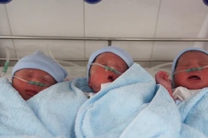 Ca sinh tam thai hiếm thấy, hai bé còn nằm trong bọc điều