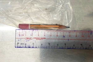 Bé trai 5 tuổi phải nhập viện vì tò mò