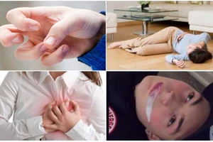 Bệnh động kinh có chữa được không hay phải sống chung suốt đời?