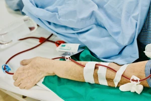 Cảnh báo nguyên nhân bệnh thận mạn tăng ở người trẻ