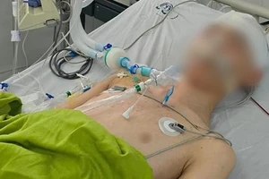 Nam sinh lớp 8 bị đánh chấn thương sọ não tử vong