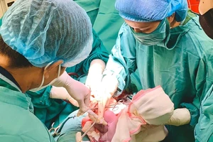 Hiếm gặp: 2 bé chào đời cùng vòng tránh thai của mẹ