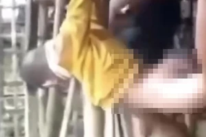 Nghi vấn cha dượng bạo hành con riêng của vợ