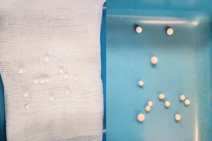 Bé trai 3 tuổi mắc 12 dị vật trong hốc mũi