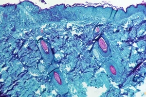 Một phần mô da được lấy từ vết thương trên da của một con khỉ bị nhiễm virus đậu mùa khỉ vào năm 1968.