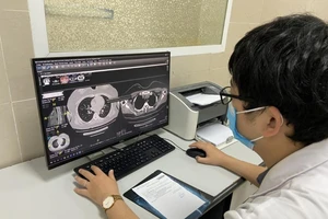 Khỏi COVID-19 vẫn ho nhiều có phải phổi bị tổn thương?