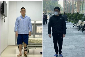 Kéo dài chân tới 18 cm cho chàng trai 23 tuổi 