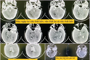 Đang ngồi làm việc, người đàn ông bất ngờ gục xuống
