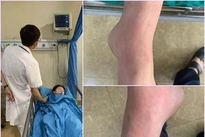 Bé gái 13 tuổi hôn mê sau khi ăn tôm, cua 