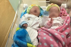 Cặp sinh non tí hon 25 tuần tuổi được nuôi sống kỳ diệu 