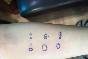 Hiếm gặp: Cô gái sốc phản vệ sau khi ăn bánh mì 