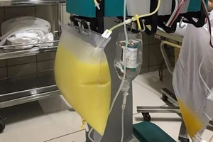 Người phụ nữ có huyết tương trắng như sữa