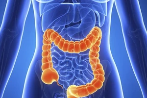 Infographic: 10 thực phẩm tự nhiên giúp nhuận tràng