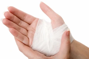 Mẹo hay dễ làm: Mẹo cầm máu vết thương