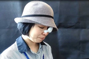 Tâm sự của nữ sinh bị tạt acid trở về sau phẫu thuật