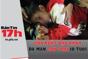 Bản tin 17h: Cha ruột bạo hành dã man con trai 10 tuổi