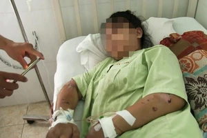 Cô gái kể về việc mình bị tra tấn dã man dẫn đến sẩy thai
