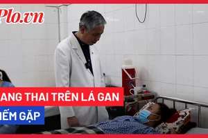 Video: Mang thai trên lá gan hiếm gặp, cô gái suýt chết