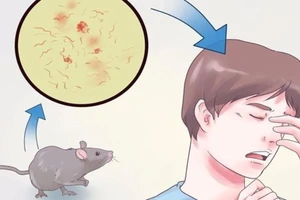 Thức ăn bị chuột gặm, ăn có bị sao?