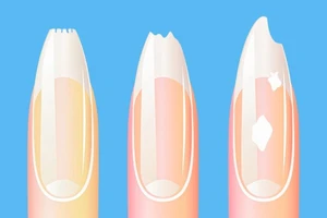 10 thay đổi trên cơ thể bạn cần biết để thay đổi chế độ ăn