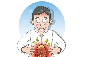 Căn bệnh ung thư nào đang xếp đầu tại Việt Nam?