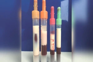 Máu chuyển sang màu sữa chỉ vì quá béo