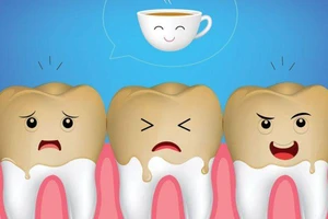 Thích uống cà phê nhưng sợ răng ố vàng, phải làm sao?