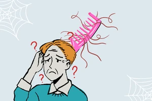 Ăn gì để giảm rụng tóc, hói đầu ở nam giới?