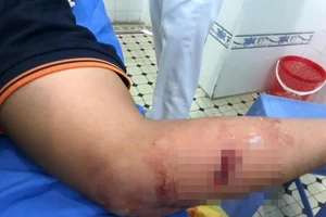 Một giám đốc ở Bình Thuận bị chém vô cớ